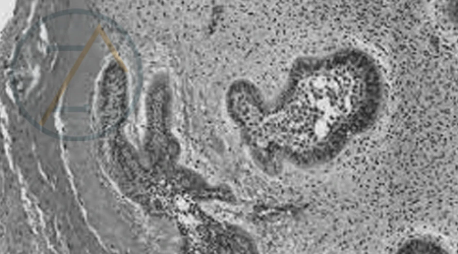 Microscopia de tecido bucal mostrando glândulas salivares para diagnóstico em patologia oral